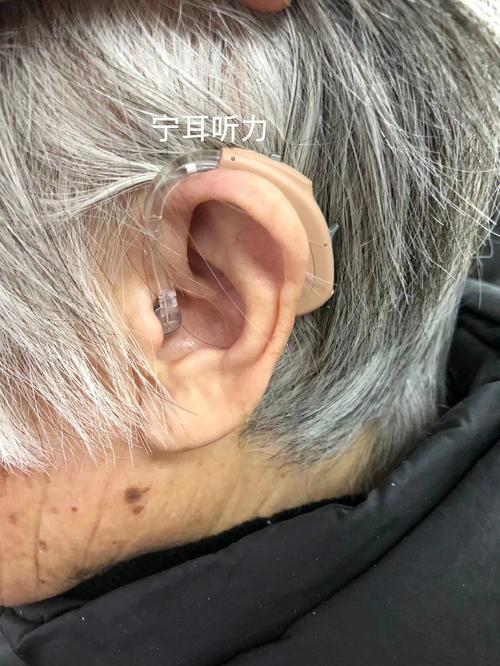 老年人專用助聽器有哪些（性價比高的老人助聽器有哪些）1