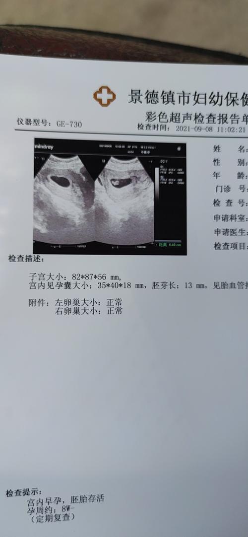 懷孕多久才能看得到孕囊（孕囊是懷孕多少時間才能看得清楚的）1