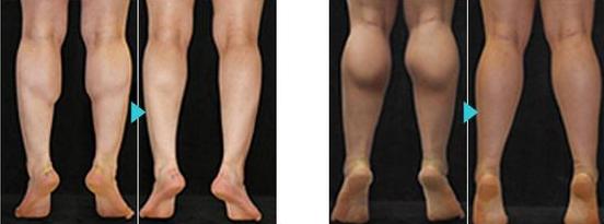 這6個動作助你改善小腿腿型（小腿是決定腿長的關鍵）2