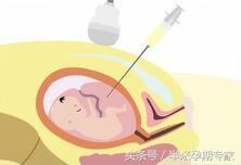 孕期産檢時間和項目表（孕期産檢的流程及注意事項）3