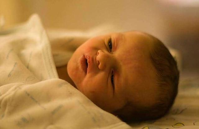 新生嬰兒黃疸怎樣才需要治療（新生兒黃疸常見）1