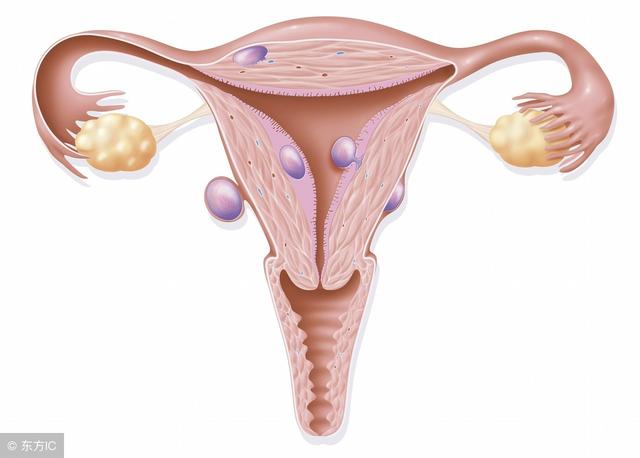 子宮肌瘤是不是不能吃補血的東西（子宮肌瘤病人應避免補血益氣的食品）2