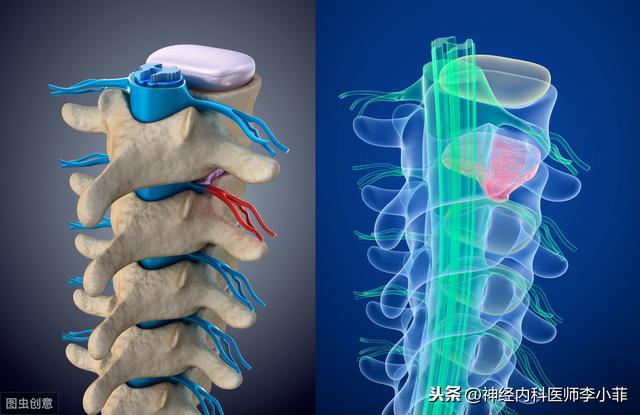 脊髓損傷康複可能遇到的困難（脊髓損傷後有沒有必要康複治療）2