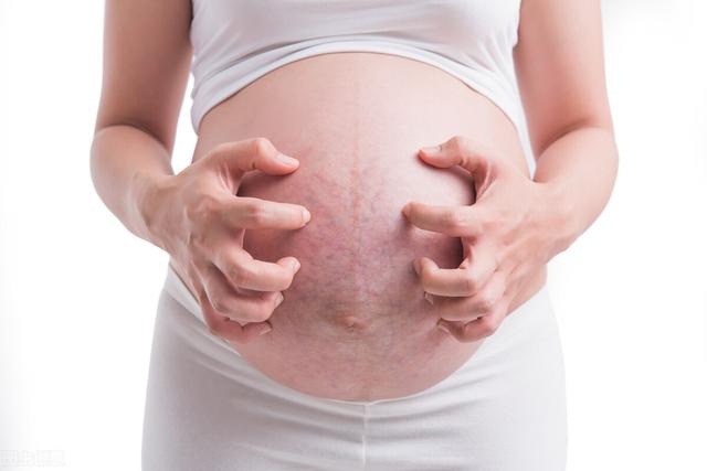 孕期皮膚瘙癢是胎兒的什麼原因（孕期皮膚瘙癢怎麼回事）(1)