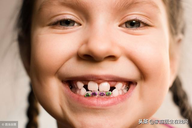 兒童前面牙齒不齊要局部矯正嗎（兒童牙齒不齊什麼時候能矯正）3
