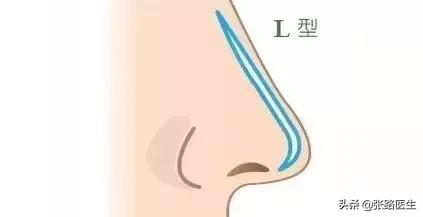 隆鼻後鼻尖持續紅腫是怎麼回事（隆鼻後鼻子持續紅腫怎麼辦）6
