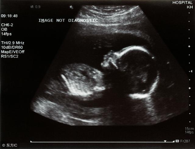 孕40周b超參考标準數據（0-40周胎兒B超數值對比）6
