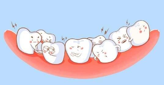 牙齒矯正最佳年齡段是什麼時候（什麼年齡做最合适）3