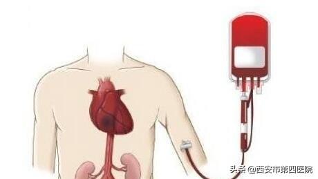 輸血必要的條件（大家對輸血治療竟有如此誤區）1