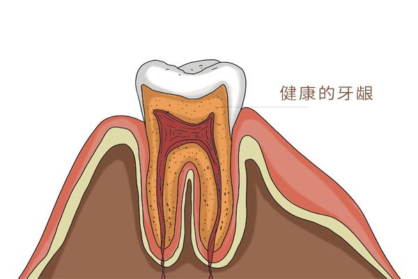 牙周炎引起的牙活動了自己能掉嗎（牙周炎一般有哪些表現）1