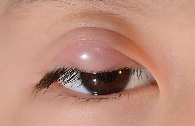 怎麼改善眼部紅血絲（想要眼睛電力十足）4