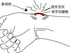手指腱鞘炎為什麼叫鼠标手（辟謠:鼠标手就是腱鞘炎）14