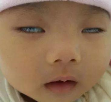 兩個月新生兒頻繁翻白眼（剛出生2個月寶寶總翻白眼）2