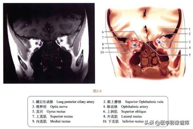 ct與mri斷層解剖學袖珍圖譜電子版（眼眶MRI斷層解剖速查圖譜）9