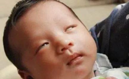 兩個月新生兒頻繁翻白眼（剛出生2個月寶寶總翻白眼）1