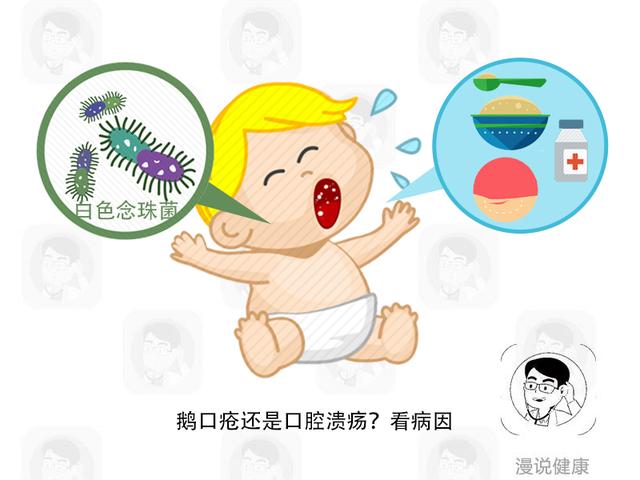 寶寶有鵝口瘡需要治嗎（寶寶口瘡和鵝口瘡如何區别）3