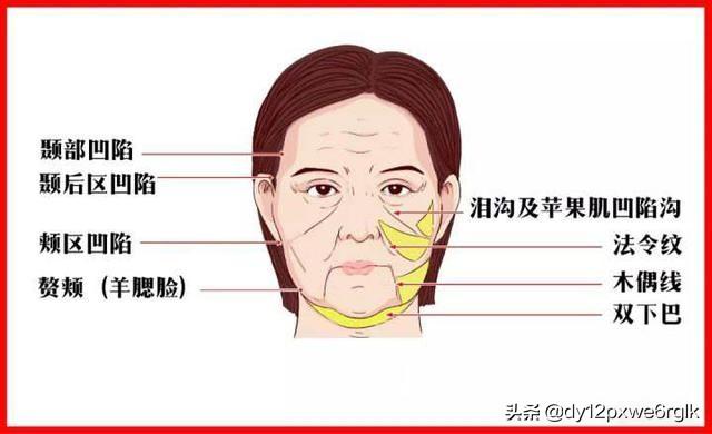 小切口除皺面部提升能維持多久（小切口除皺術能改善哪些面部問題）1