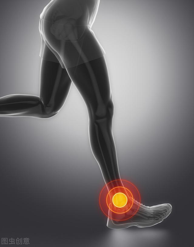 踝關節扭傷内側最容易損傷的原因（踝關節負重大易扭傷）3