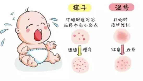 一個多月寶寶過敏性咳嗽怎麼辦（寶寶咳嗽1月治療不見好轉）2