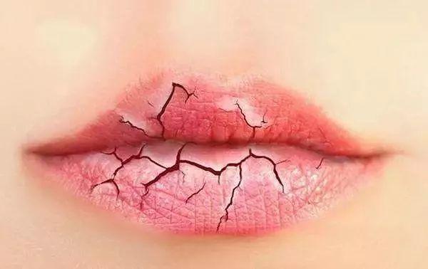 冬天嘴唇幹起皮是什麼原因引起的（冬季嘴唇發幹起皮不是缺水）1