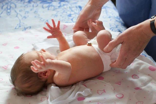 新生兒臍帶的護理及異常情況處理（關于新生寶寶臍帶護理那些事）9