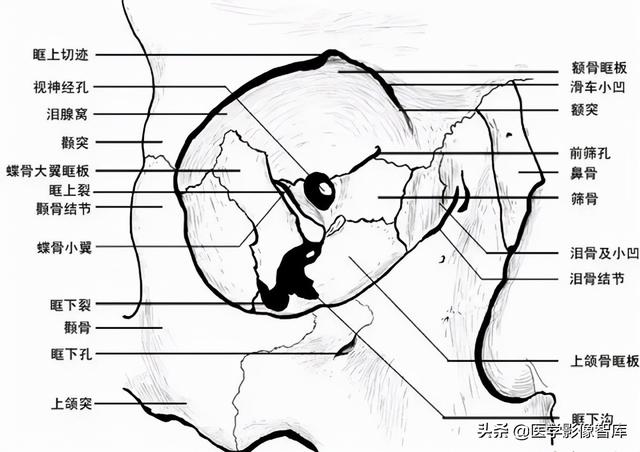 ct與mri斷層解剖學袖珍圖譜電子版（眼眶MRI斷層解剖速查圖譜）29
