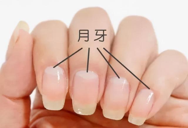 手指到底有月牙還是無月牙健康（手指月牙多和手指月牙少）2