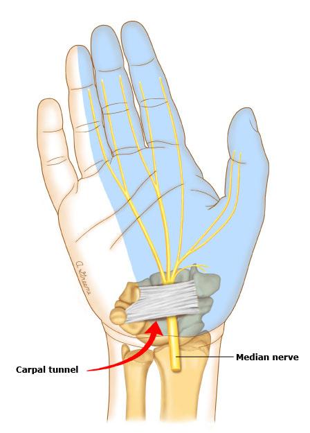 手指腱鞘炎為什麼叫鼠标手（辟謠:鼠标手就是腱鞘炎）4