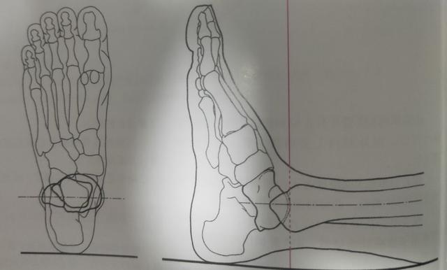 踝關節跟骨畸形x線描述（學習X線讀片指南骨）2