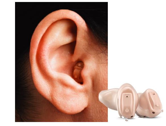 常用助聽器的選配原則和方法（如何選擇正确的助聽器）5