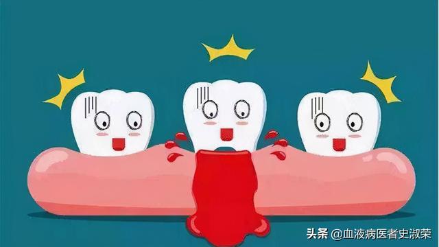 牙龈出血屬血液病怎麼辦（疾病判斷總是牙龈出血）2