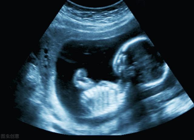 b超胎心胎芽怎麼還會胎停（這個寶寶或許與你無緣）2