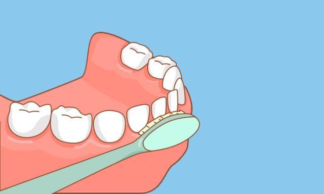 如何正确刷牙會更愛護自己的牙齒（如何刷牙才能保護牙齒健康）2