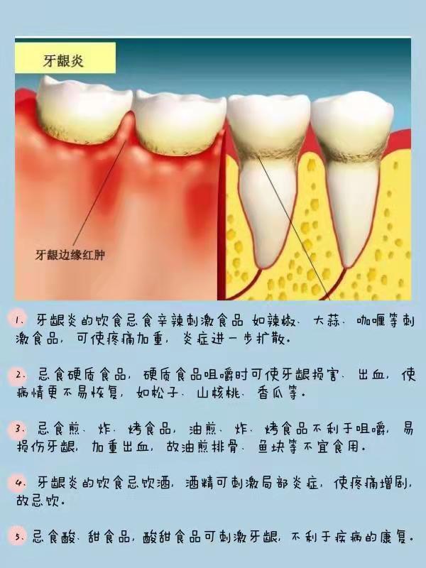 牙齒和牙龈長期出血怎麼回事（為什麼總是牙龈出血）4