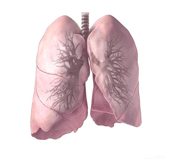 痰非常多是慢性咽炎還是肺部感染（肺部有問題喉嚨先知）4