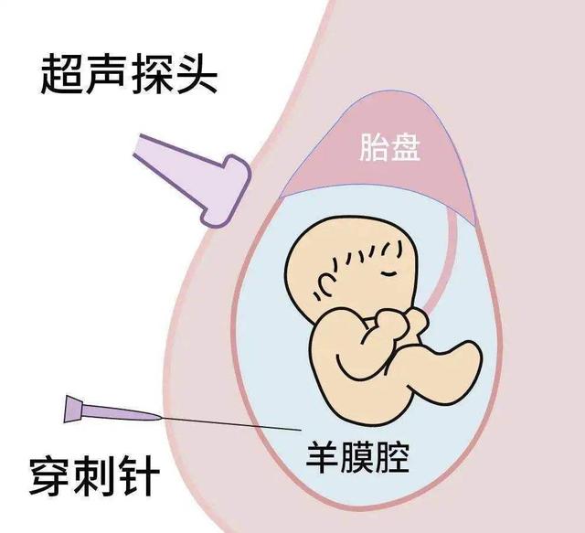 孕婦孕吐反應越強烈小孩越聰明嗎（孕吐嚴重胎兒心率快）6