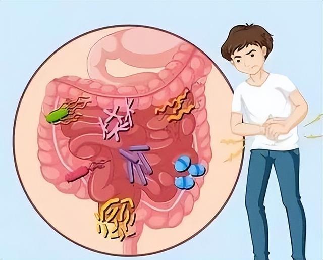 胃腸紊亂的症狀和表現（胃腸功能紊亂的症狀有哪些）1