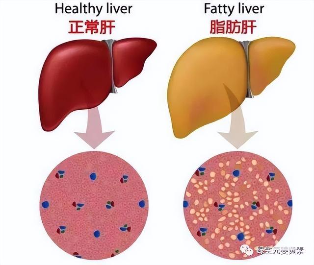 簡述肝在糖代謝中的特點（肝髒是糖脂肪蛋白質代謝的主要器官）1