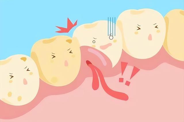 牙龈腫了個肉坨嚴不嚴重（牙龈怎麼突然腫起來個粉嘟嘟的肉坨）1