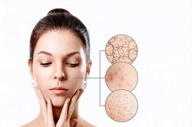 什麼護膚品适合幹性皮膚抗衰老（皮膚松弛暗沉長皺紋）2