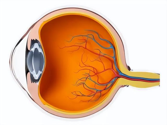 眼底疾病初期症狀（眼底一張照眼病早知道）3