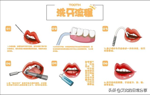 洗牙現場你的牙洗了嗎（愛護牙齒之洗牙篇）3