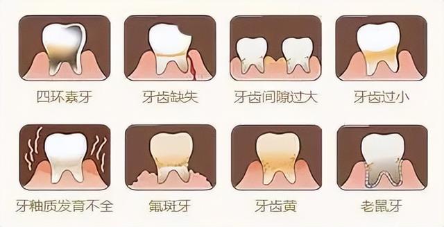 比較好用的修複牙齒的方法（一項修複牙齒的技術）6